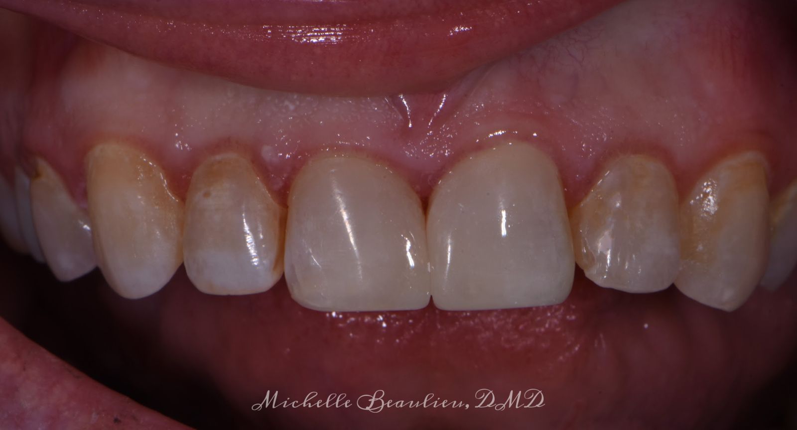 Dr Beaulieu's Work Brightwork Dental Care